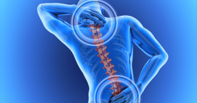 Image showing low back pain, Canva